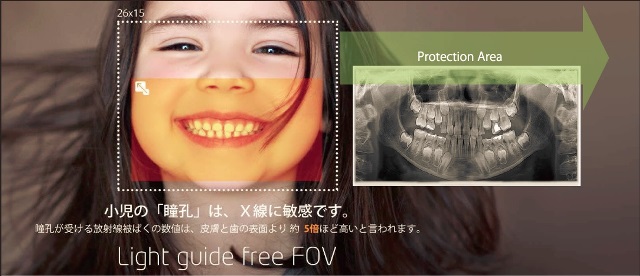 子供の瞳への照射は厳禁